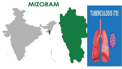 At 145, Mizoram recorded six-year high TB deaths in 2025 