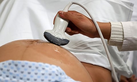 Control prenatal, primordial en la prevención de la muerte materna