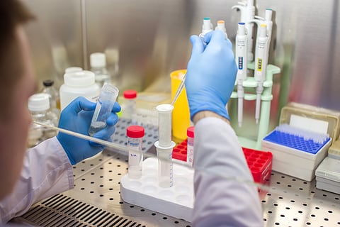 Células madre mesenquimales: una esperanza para el lupus