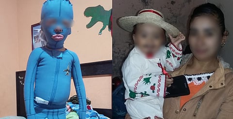 Chuchito, un pequeño guerrero que sólo pide un pastel para su cumpleaños