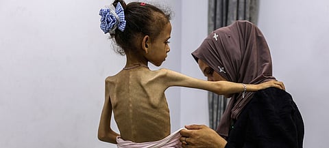ONU alerta que 39% de la población en Gaza no come durante varios días