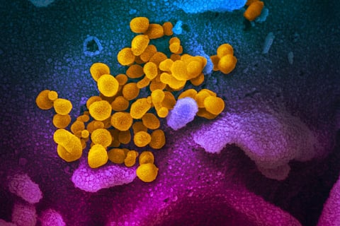 Brote en crucero pone atención sobre el contagioso norovirus
