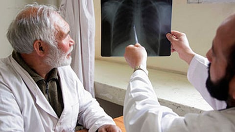 Este 24 de marzo es el Día Mundial de la Tuberculosis, conoce cuáles son sus síntomas