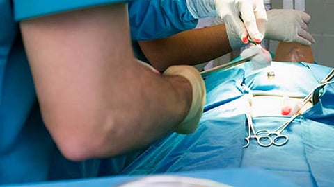 Hay en lista de espera 276 pacientes que requieren un riñón o córnea en la entidad (Foto: Cortesía)