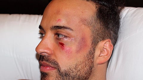 Apio Quijano compartió una fotografía de los golpes que sufrió