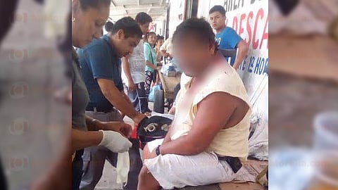 El hombre recibió una pedrada en la cabeza (Foto: RED 113)