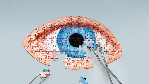 Foto Ilustrativa (Facebook: 
@clinicadeojosmty)