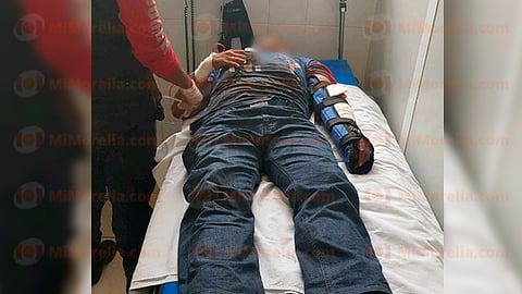 El lesionado fue trasladado a un hospital en Zamora (Foto: RED 113)