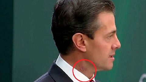 La causa es el estrés señalaron dermatólogos (Foto: captura de pantalla)