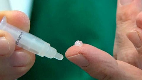 Una vez aplicado el medicamento, la erección se producirá de entre los cinco y 30 minutos (Foto: CuidatePlus)