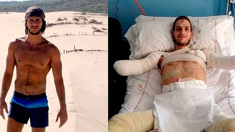 El joven jamás perdió el sentido del humor, y tuvo que seguir luchando para seguir con vida (Foto: Instagram)
