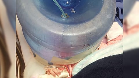 Ha causado polémica en redes el uso de un garrafón de plástico, a modo de “casco de oxígeno” improvisado para salvar la vida de la bebé (Foto: Facebook/Maripoza Monarka)