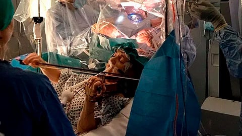 Se buscó ptoteger las células importantes ubicadas en el lóbulo frontal derecho de su cerebro (Foto: @KingsCollegeNHS)