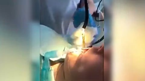 El animal se introdujo en la boca de la mujer mientras dormía (Fotograma YouTube: Cobrapost)