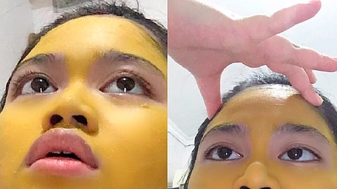 El color amarillo de su rostro desapareció dos días después (Foto: @ibuibuyakult)
