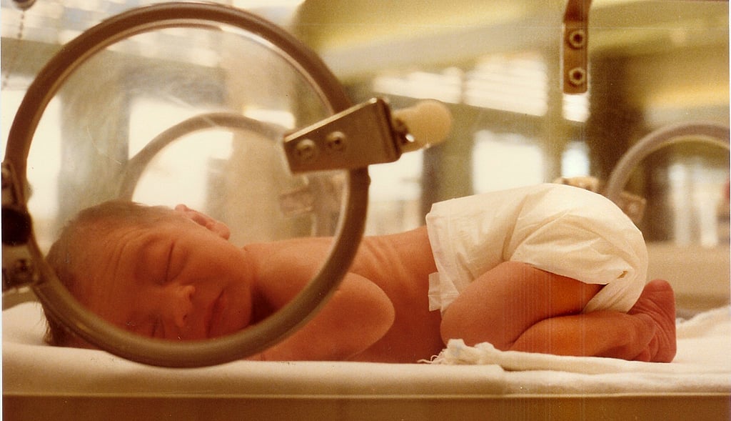 AI may help evaluate brain maturity in preterm infants