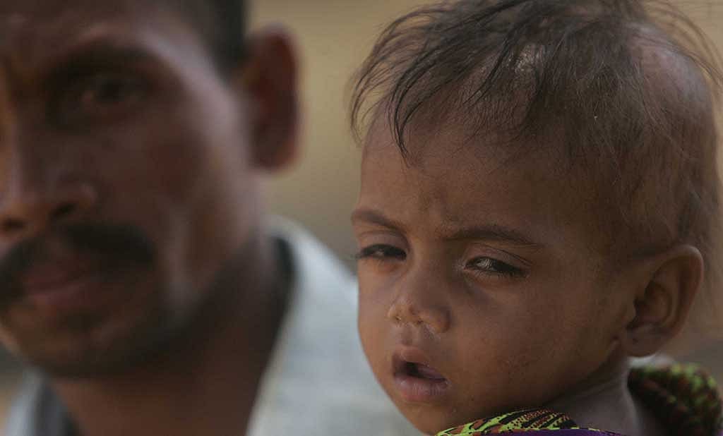 BJP-ruled states  high on malnutrition index