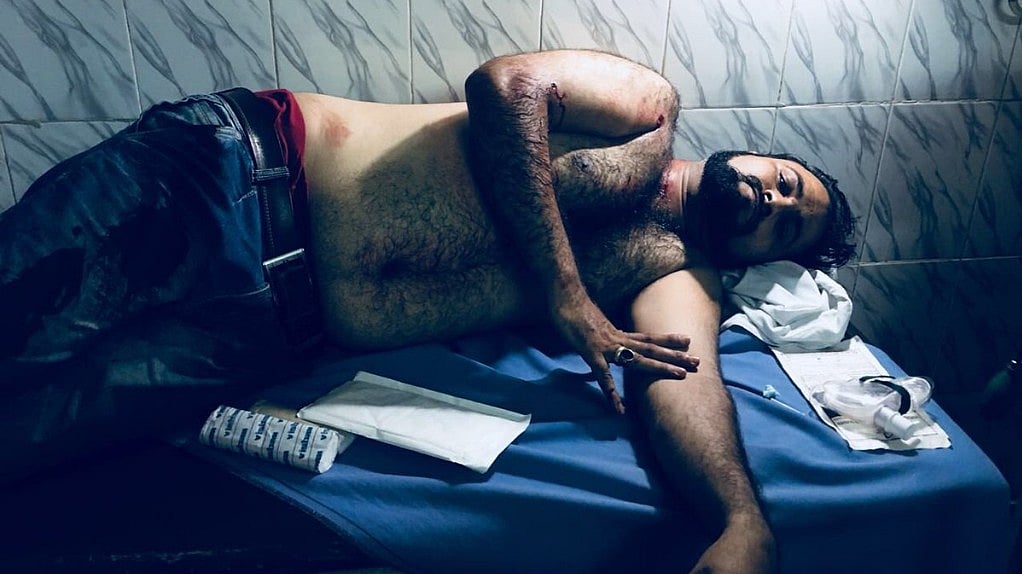 Deadly attack on Dr Kafeel Khan’s brother in Gorakhpur, Uttar Pradesh
