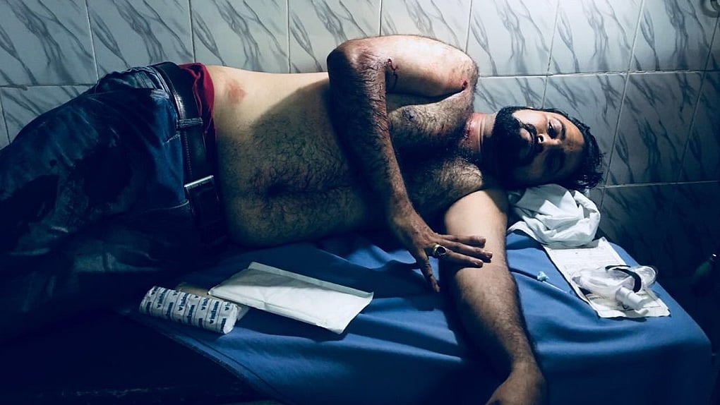 Kashif Jameel, brother of Dr Kafeel Khan, awaits surgery at a Gorakhpur hospital on Sunday night, after he was shot at by bike-born assailants a short distance from the Gorakhnath temple