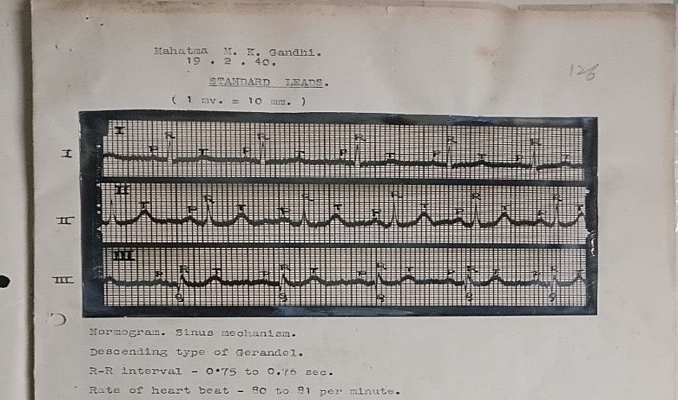 Now listen to Mahatma Gandhi’s heart beat at Gandhi Museum, Delhi