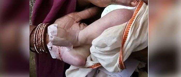In Bihar govt hospital, newborn dies of rat bites
