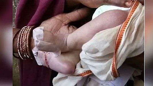 In Bihar govt hospital, newborn dies of rat bites