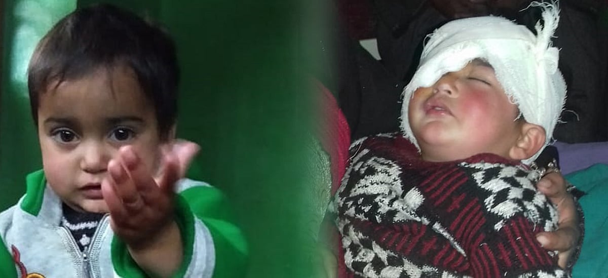 Kashmir: 19-month-old baby becomes the youngest pellet gun survivor 