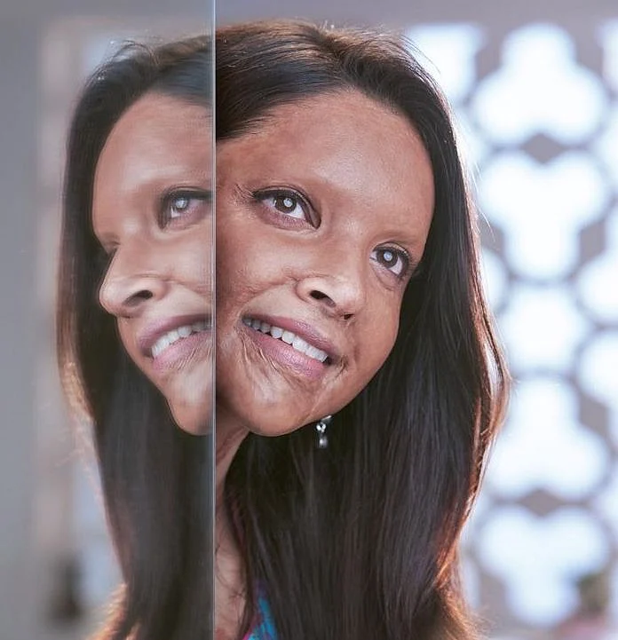 Meghna Gulzar’s ‘Chhapaak’ is a film about the indomitable human spirit