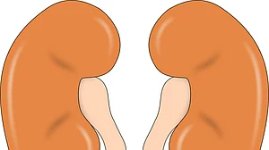 In a rare gesture, Hindu, Muslim couples undergo kidney swap transplant in Punjab