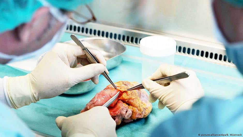 Representative image. Maximum number of people have pledged to donate a kidney, followed by heart, liver, lungs, pancreas and intestine. (Photo: Getty Images)