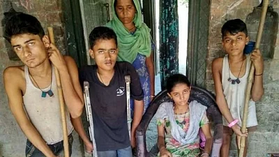 4 of a UP family affected with polio