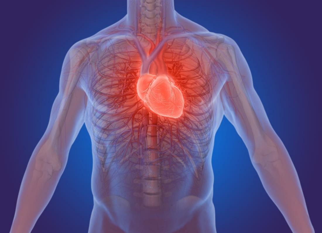 Heart disease, stroke-related deaths on rise due to obesity