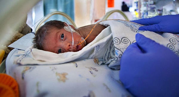 Nestle violates law in India, conducts clinical trials on premature infants for baby food