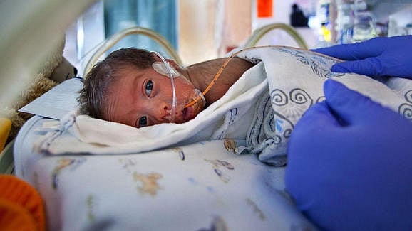 Nestle violates law in India, conducts clinical trials on premature infants for baby food