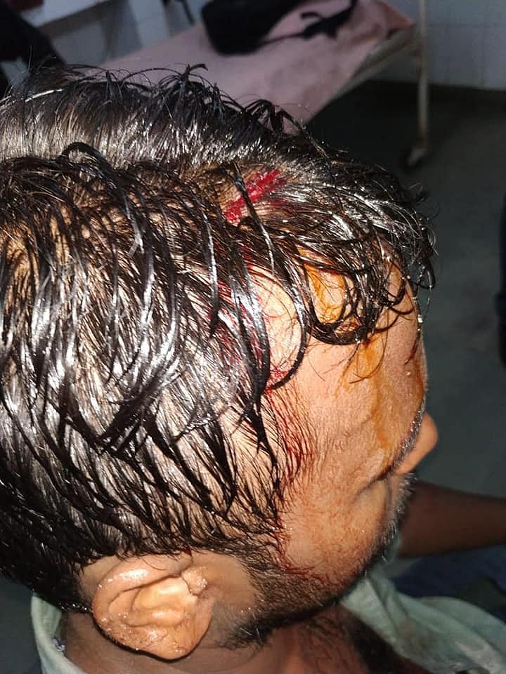 Dalit Left activist attacked in JNU, allegedly by ABVP member
