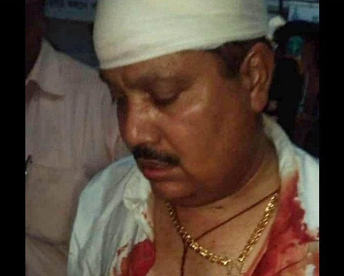 West Bengal: BJP MP Arjun Singh suffers head wound in clash with police