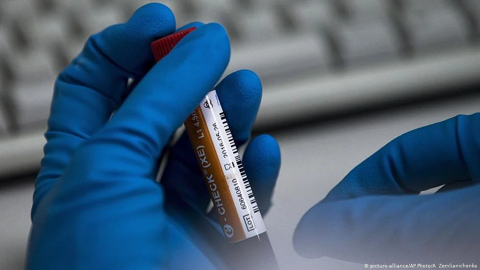 India has a positivity rate of 3.6%, highest among all major testing nations.