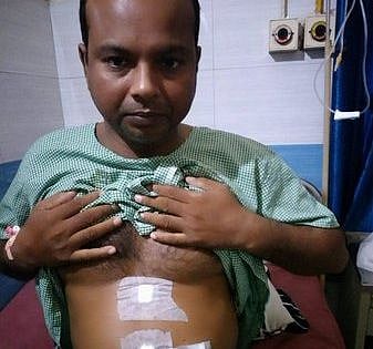 Shocking! This Uttar Pradesh  man has all organs on wrong side  