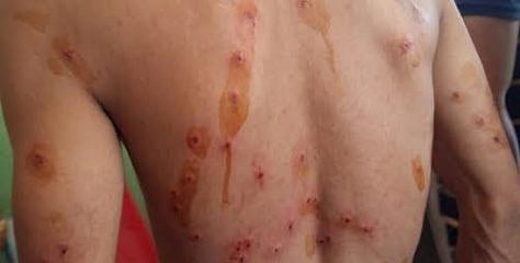Since 2016, mostly young people fell victim to pellet guns in Kashmir, says report by human rights association