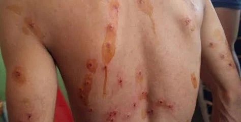 Since 2016, mostly young people fell victim to pellet guns in Kashmir, says report by human rights association