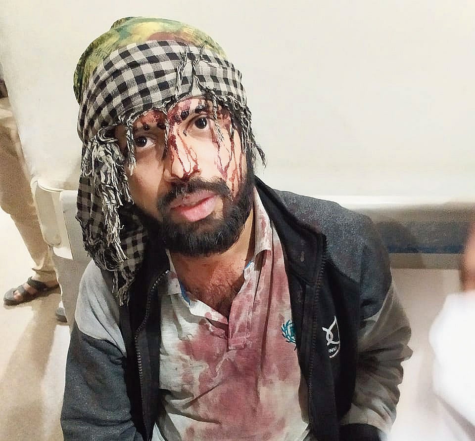 Student Sandeep Lewis injured near JNU