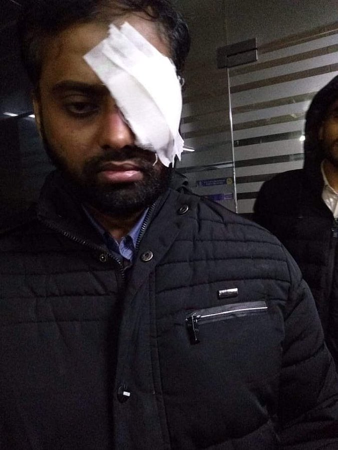 Jamia student loses one eye during alleged police action on campus
