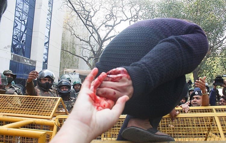 WATCH: Man fires at protesters in Jamia area of Delhi, shouts ‘who wants Azadi’, one injured
