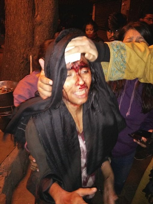 JNU Students Union president Aishe Ghosh was attacked brutally with rods/sticks.&nbsp;