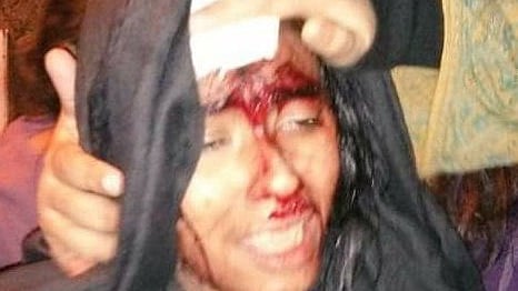 Masked mob terrorises JNU campus, 24 students and teachers injured
