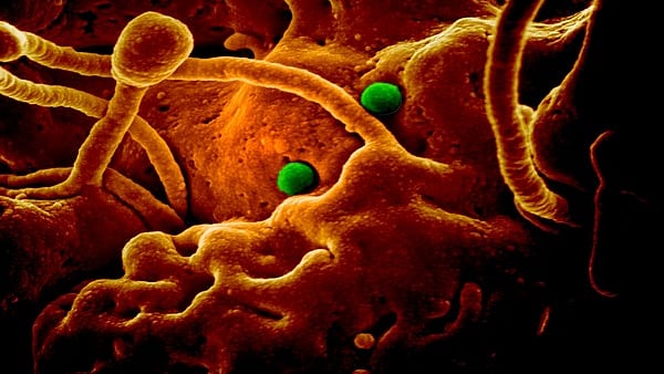 Corona Virus outbreak in China, world on alert