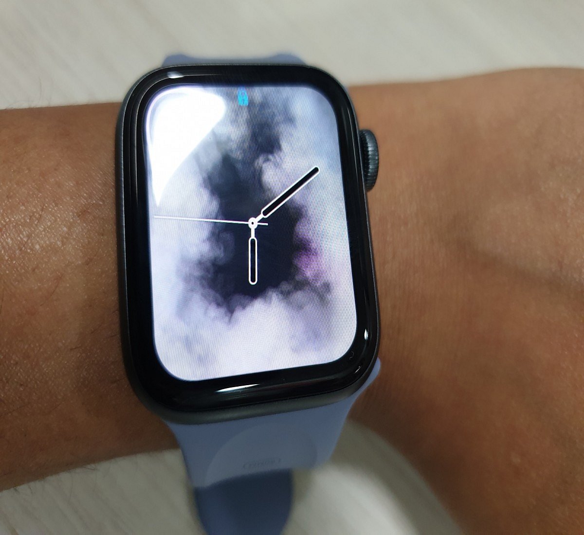 Apple Watch helps save life of teen athlete