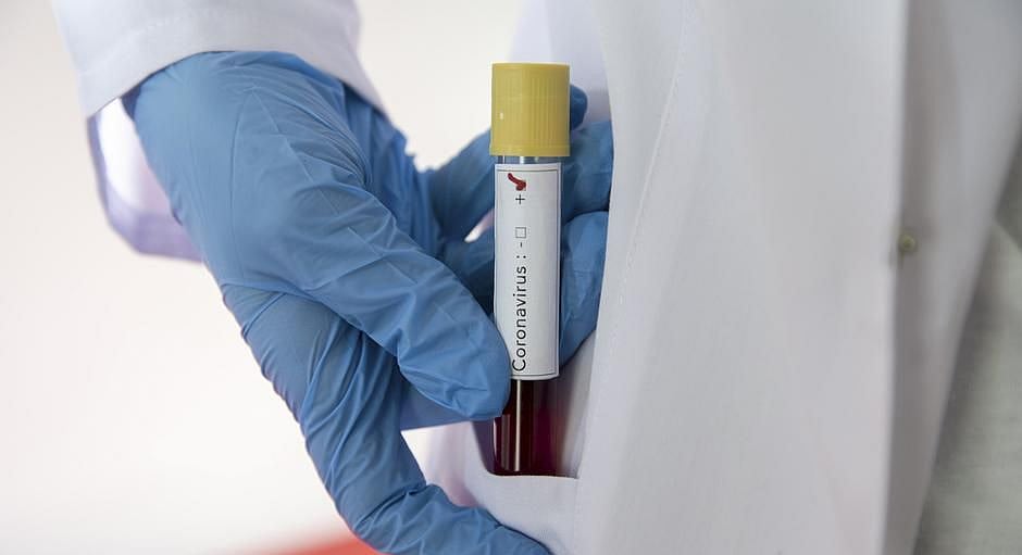 Anti-malarial drug currently only remedy for COVID-19: Experts