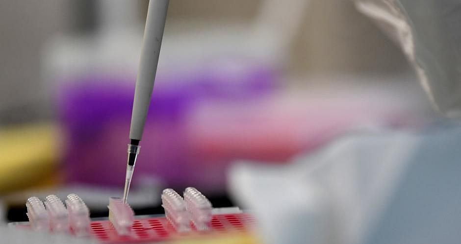 COVID-19 patients lose sense of smell by third day of infection  