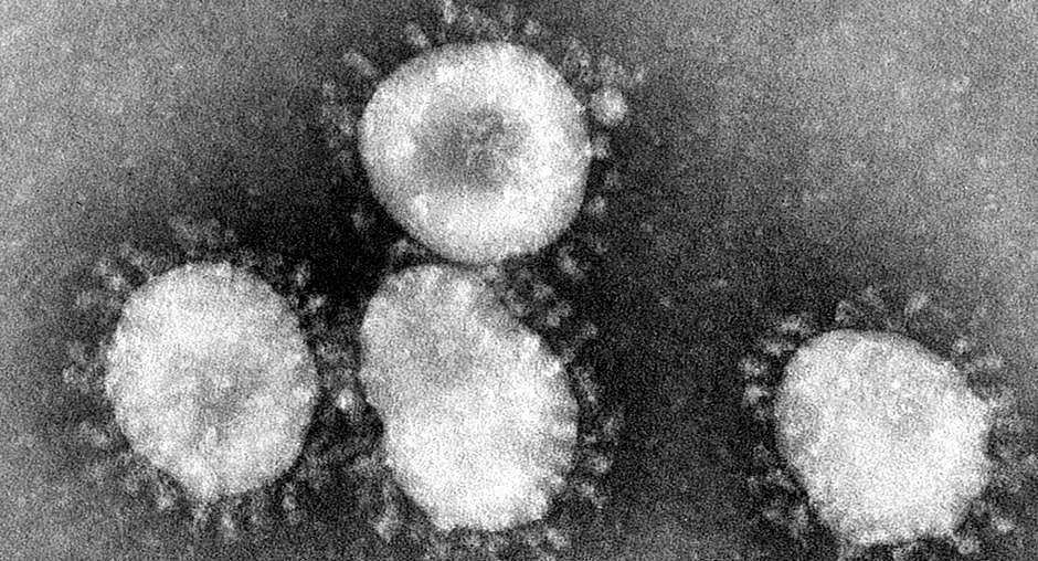 9 swine flu deaths in Uttar Pradesh, 17 PAC jawans test positive